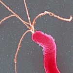 a bacterium