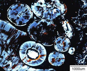 An image of a tumor made of teeth.