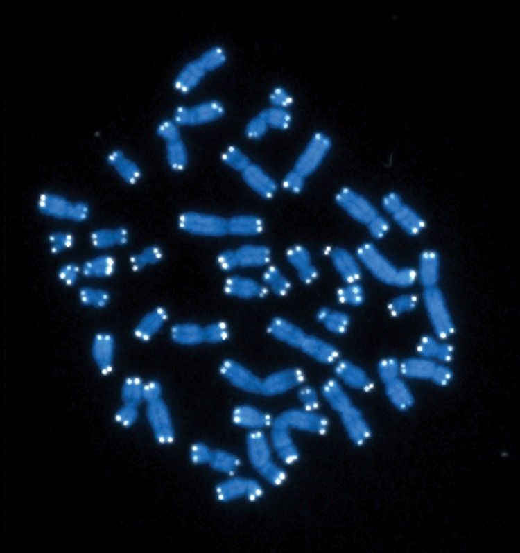 The 46 chromosomes of the human genome, with telomeres highlighted in white.