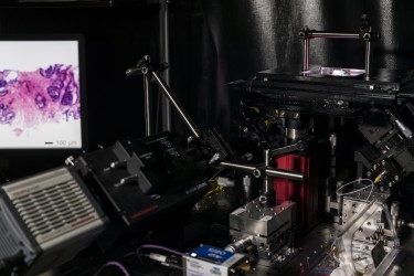 A versatile light-sheet microscope developed at the University of Washington can provide surgeons with real-time pathology data to guide cancer-removal surgeries and can also non-destructively examine tumor biopsies in 3-D.