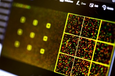 Image of DNA sequencing output