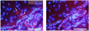 cells infected with zika virus