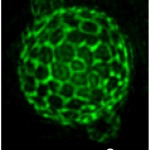 A vacuole in a yeast cell.