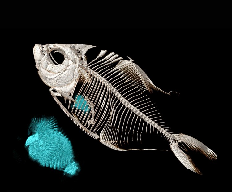 CT scan