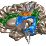 Depiction of the left hemisphere of the human brain