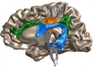 Depiction of the left hemisphere of the human brain