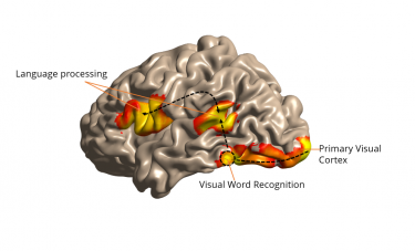 This illustration of the side view of the brain -- the front of the brain is at left -- shows how visual information is received in the back, and words are identified near the base, to be processed for understanding elsewhere.