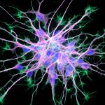 An image of neurons under a microscope