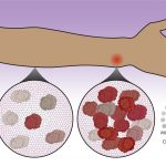 An illustration showing immune system cells migrating to a wound site.