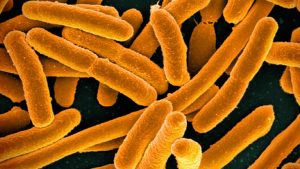 A close-up image of E. coli bacteria.