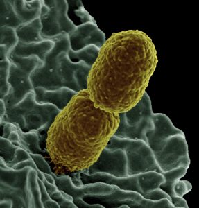 Close-up image of two Klebsiella bacteria cells.
