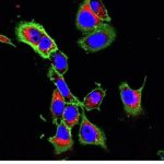 Mouse mammary cancer cells that are being treated with a nanoparticle that can deliver an anti-cancer drug into the cells.