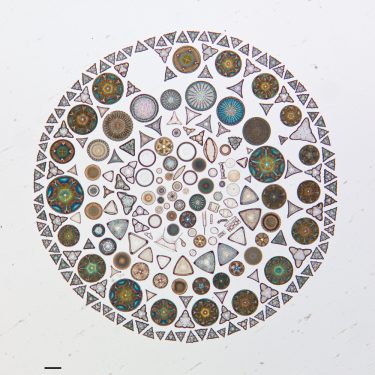 magnified cells of various shapes arranged in a mosaic