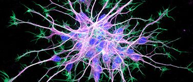 cytoskeleton of neuron on black background