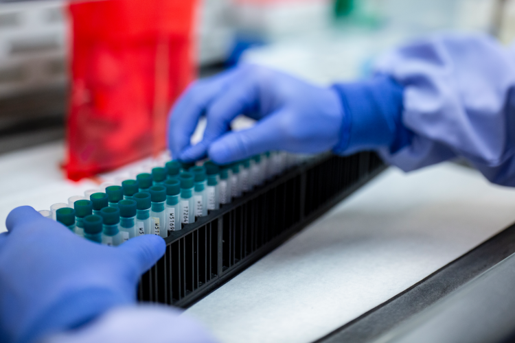 Gloved hand fills test tubes