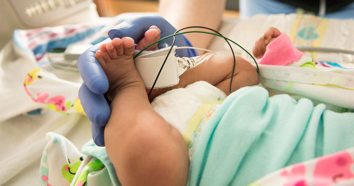 Born prematurely, Zoe Gonzalez spent several months in the Neonatal Intensive Care Unit (NICU) at UW Medical Center. She’ll take part in a research study that monitors premature babies for several years while providing them with medical checkups. (Photo by Clare McLean)
