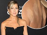 Maybe strapless wasn't such a good idea! Jennifer Aniston shows off her cupping marks at Call Me Crazy premiere