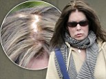 Losing her mane attraction: Now puffy-faced Lara Flynn Boyle displays thinning patches of hair on top