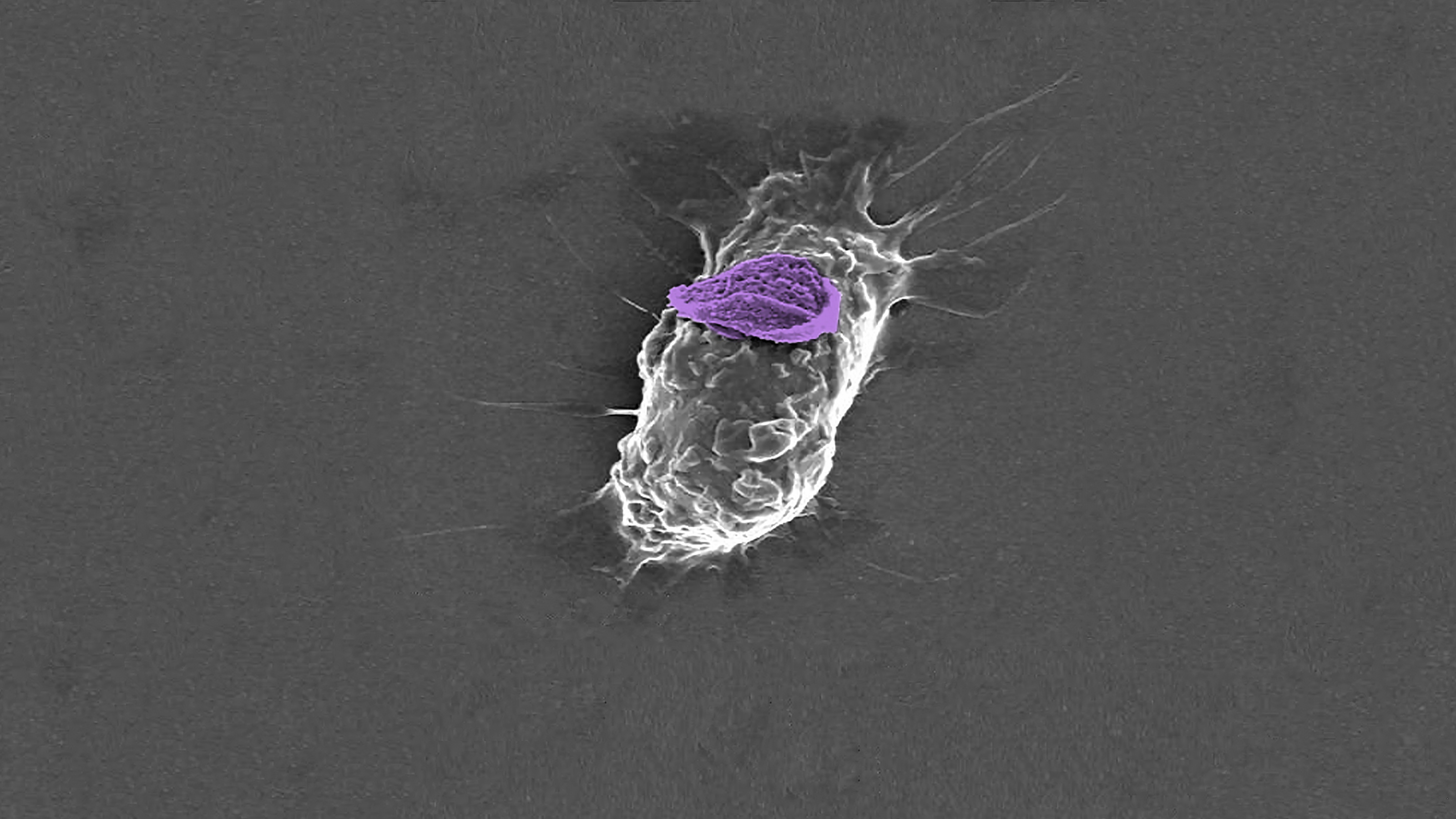 Cellular “Backpacks” to Fight Cancer, Autoimmune Disorders, and More