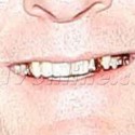 Charlie Sheen Flashes His Gold Teeth After Dinner 