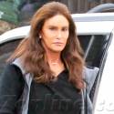 Caitlyn Jenner Is Losing Her Hair