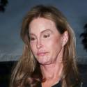 Caitlyn Jenner Has A Nasty Lip Wound!
