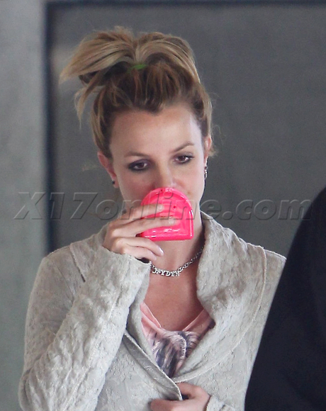 Britney Spears retainer dentist thousand oaks singer x factor 